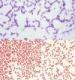 Gram-staining