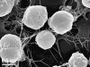 Methanococcus sp.