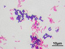 http://en.wikipedia.org/wiki/Gram_staining