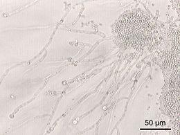 http://hu.wikipedia.org/wiki/Candida_albicans