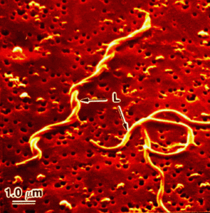 http://microbewiki.kenyon.edu/index.php/Borrelia