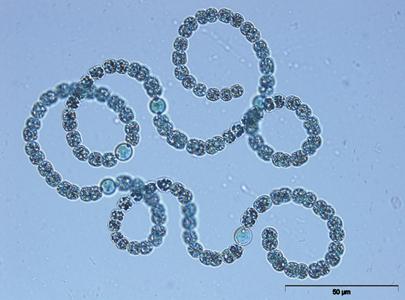 Anabaena flos-aquae