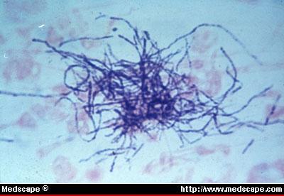 Actinomyces