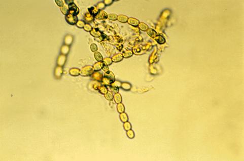 Anabaena azollae