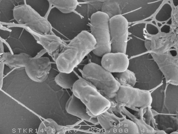 Bacillus subtilis elektronmikroszkópos képe