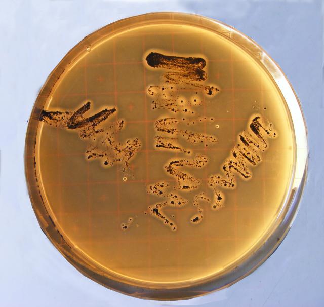 Baird-Parker agar