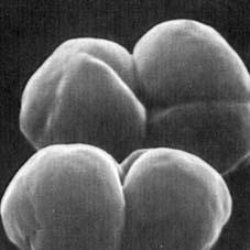 Methanosarcina barkeri