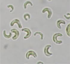 Pseudokirchneriella subcapitata