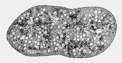 http://www.biol.tsukuba.ac.jp/~inouye/ino/bc/Rhodospirillum.GIF