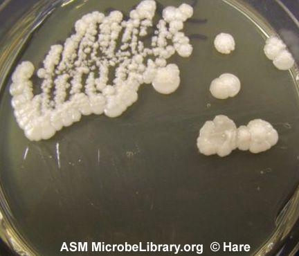 http://www.microbelibrary.org/microbelibrary/files/ccImages/Articleimages/Atlas_