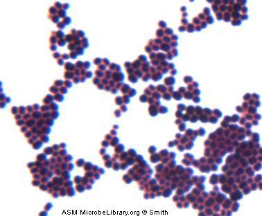 Staphylococcus aureus