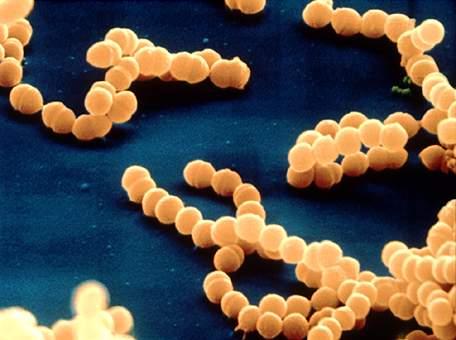 Streptococcus sp.