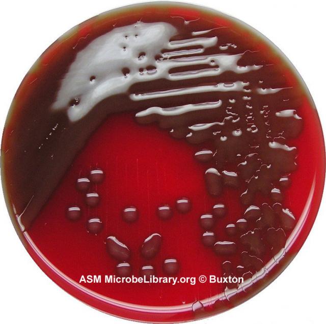 Streptococcus pneumoniae on bloody medium