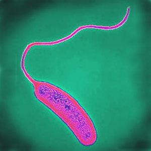 Vibrio cholerae