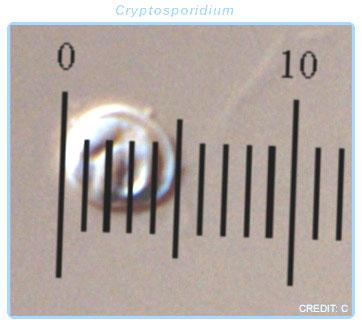 Ocular micrometer