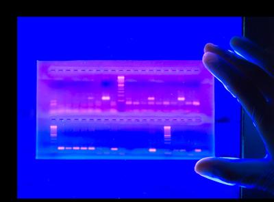 Gel electrophoresis