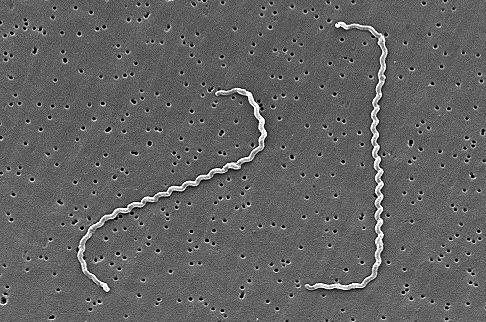 Leptospira sp.