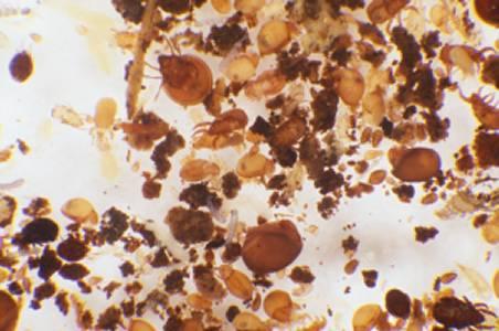 Talajlakó ízeltlábú mikroszkóp alatt extrakció után