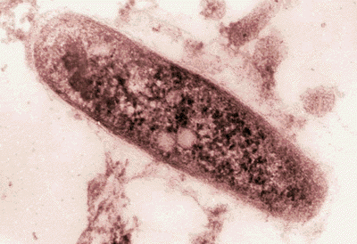 Mycobacterium tuberculosis