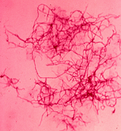 Nocardia asteroides