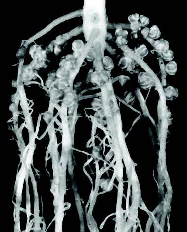 Root nodules