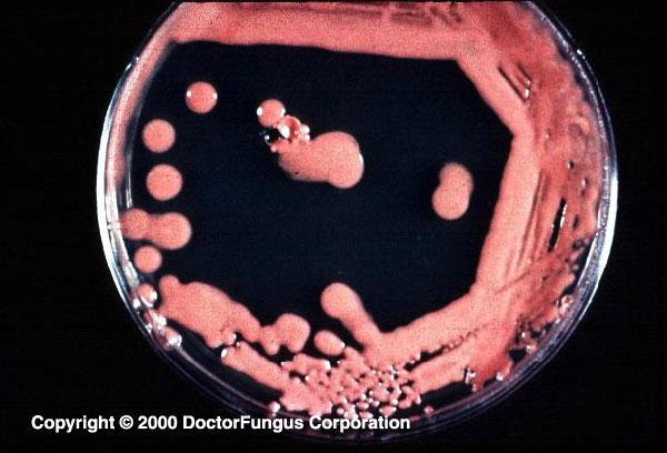 http://www.doctorfungus.org/thefungi/img/rho1_L.jpg