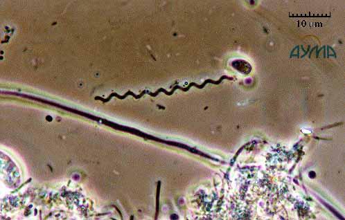 http://www.cienciesnaturals.com/microorg/miact/images/spirochaeta.gif