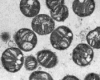 Methylococcus capsulatus