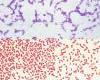 Gram-staining