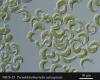 Pseudokirchneriella subcapitata egysejtű édesvízi alga