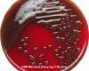 Streptococcus pneumoniae on bloody medium