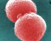 Pneumococcus