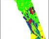 Erosion map